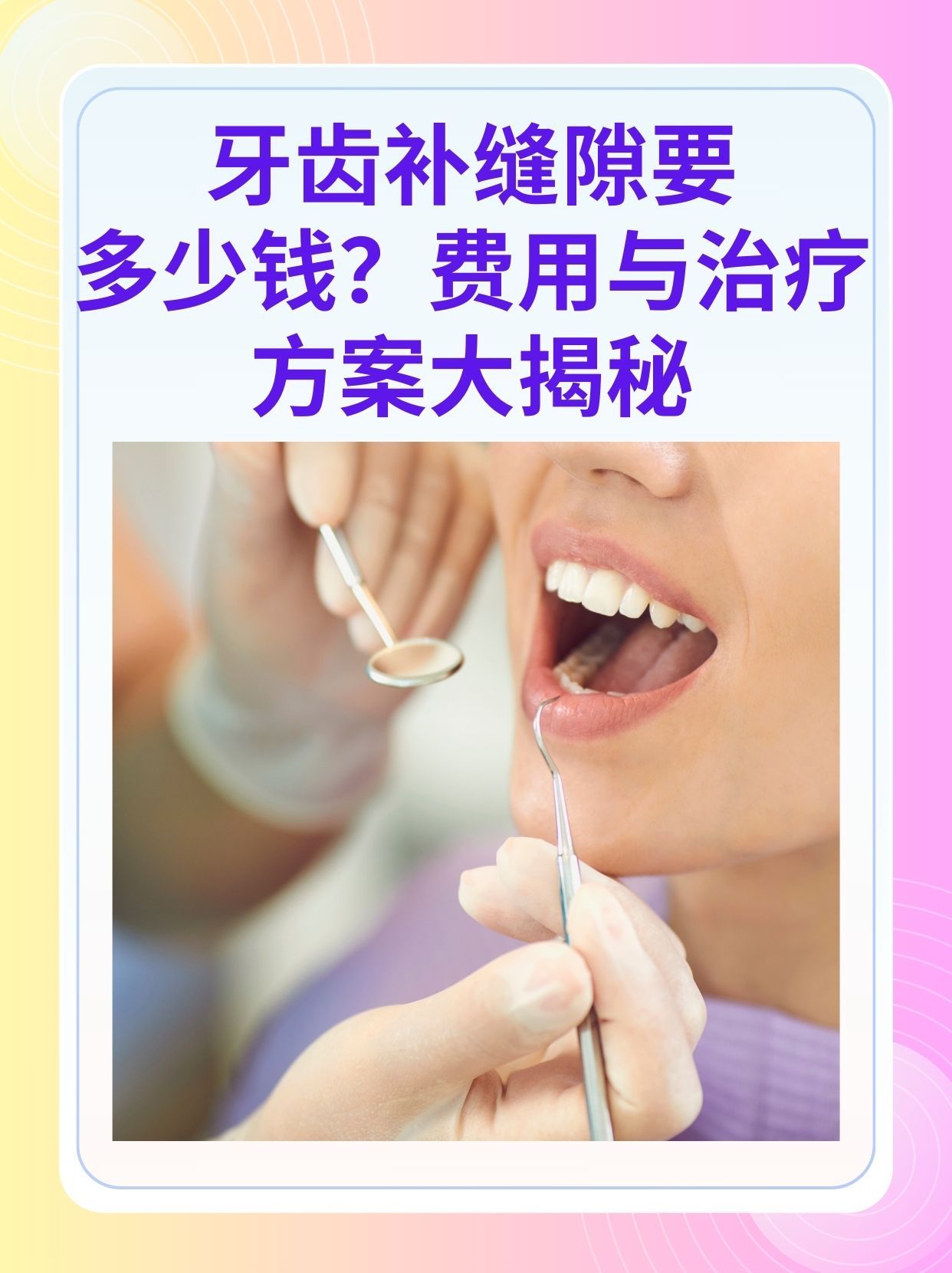 长治补牙医保可以报销吗(补牙医保可以报销吗 哪些可以报销呢)